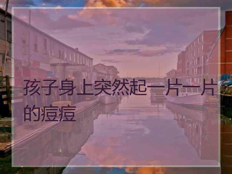 孩子身上突然起一片一片的痘痘 孩子身上突然起一片一片的痘痘